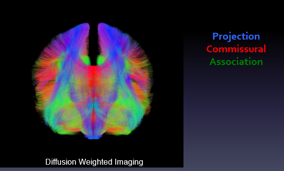 <p>projection - blue</p><p>commissural - red</p><p>association - green</p>