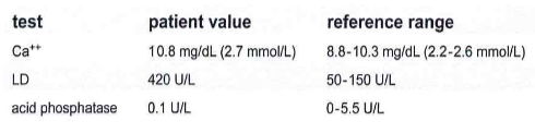 <p>298.) Serum from a patient with metastatic carcinoma of the prostate was separated form the clot and stored at room temperature. The following results were obtained. The technician should repeat the: </p><p>A. LD using dilute serum </p><p>B. acid phosphatase with freshly drawn serum </p><p>C. LD with fresh serum </p><p>D. test using plasma</p>