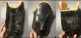 <p>Femoral condyles</p>