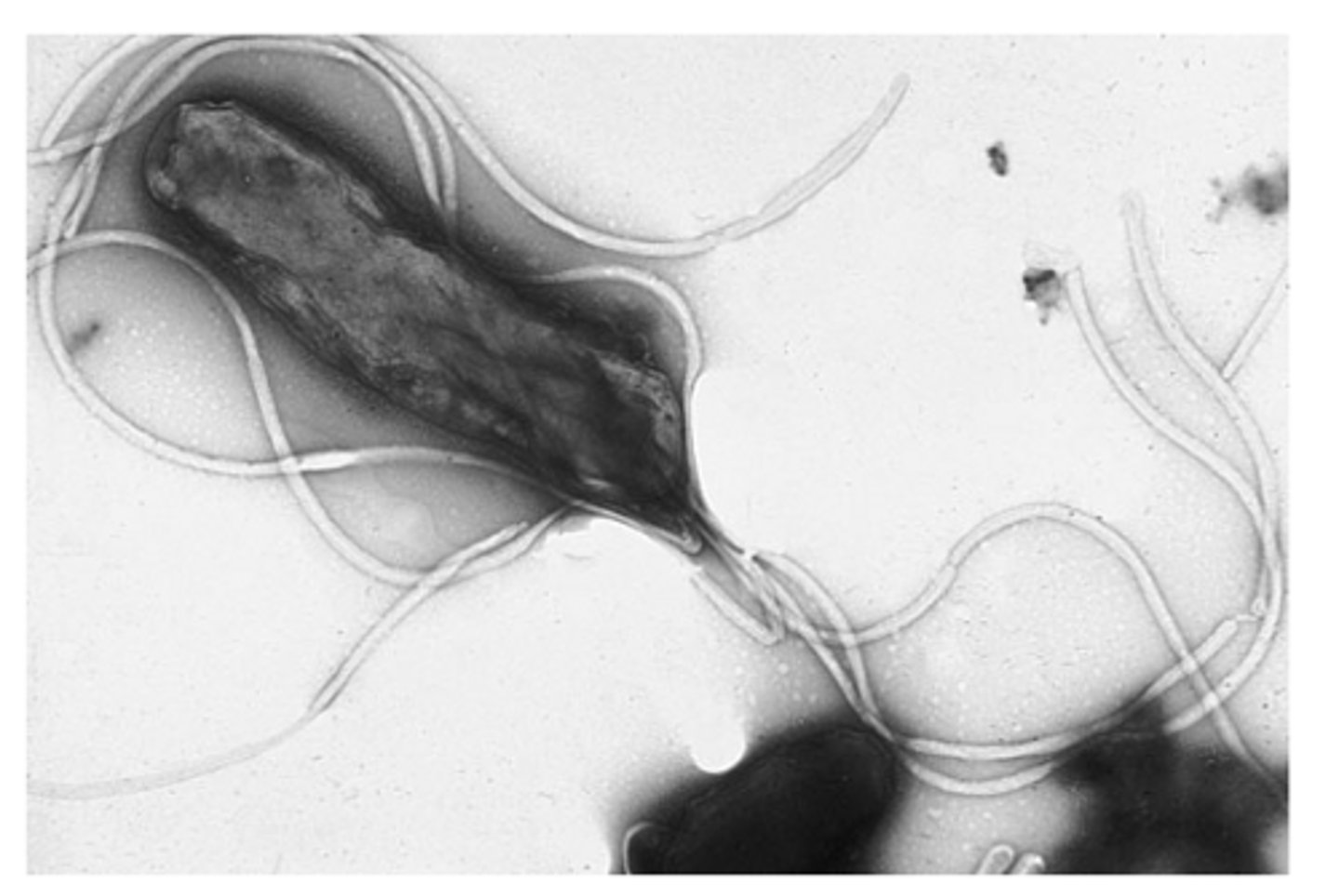 <p>What are 3 examples of severe gastroduodenal conditions that H. pylori infection leads to?</p>