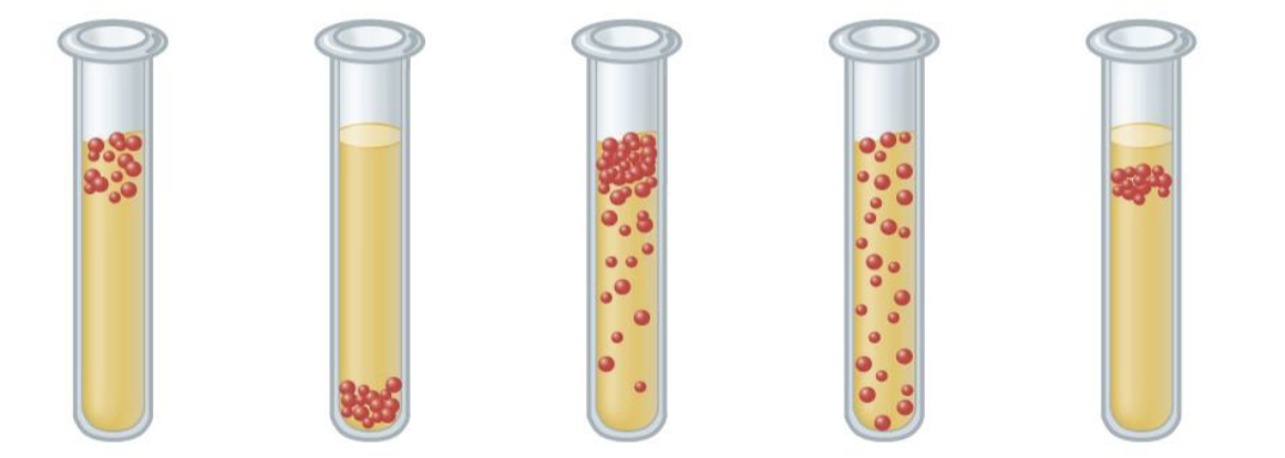 <p>What are all the correct classifications for the bacteria within these tubes?</p>