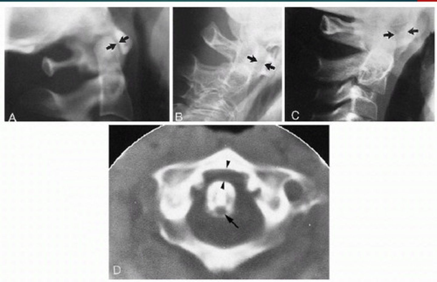 <p>What line of mensuration is this?</p>