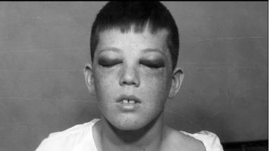 <p>The case of Howard Dully</p>