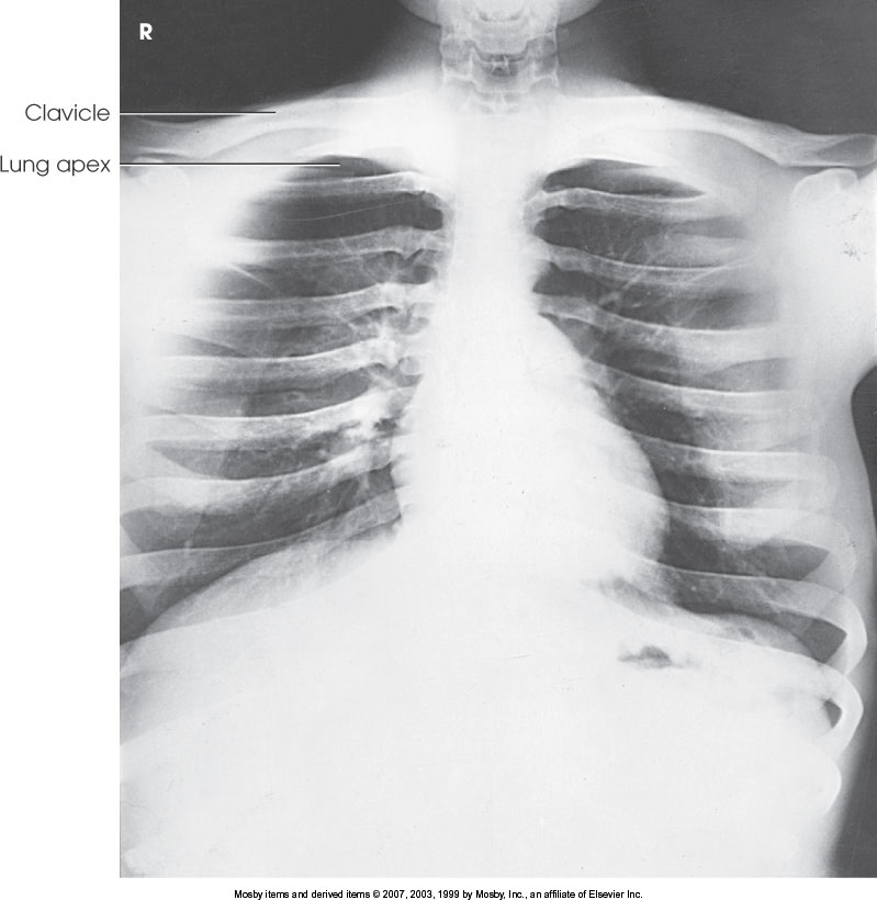 <p>What position is demonstrated?</p>