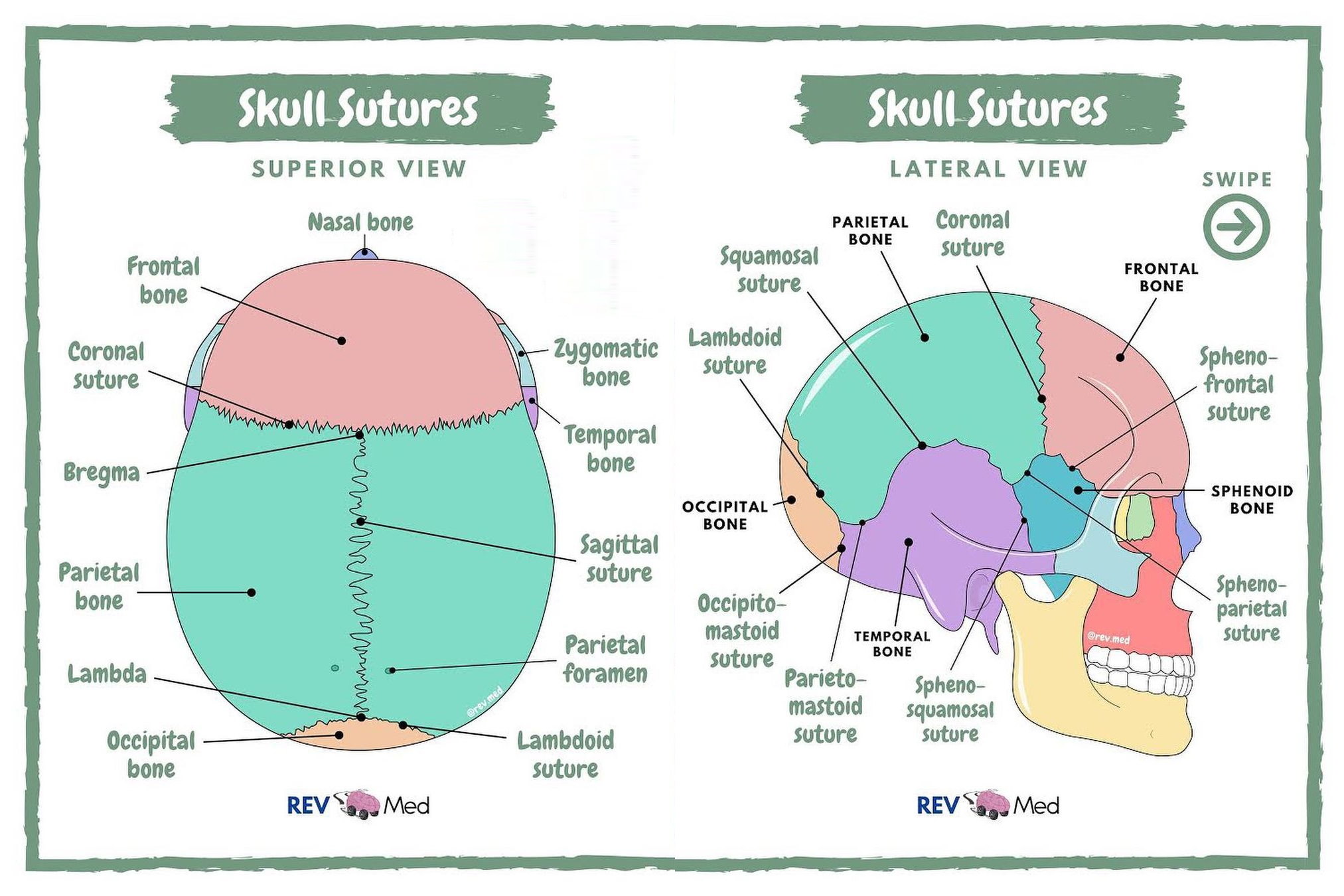 <p>Cranial sutures</p>