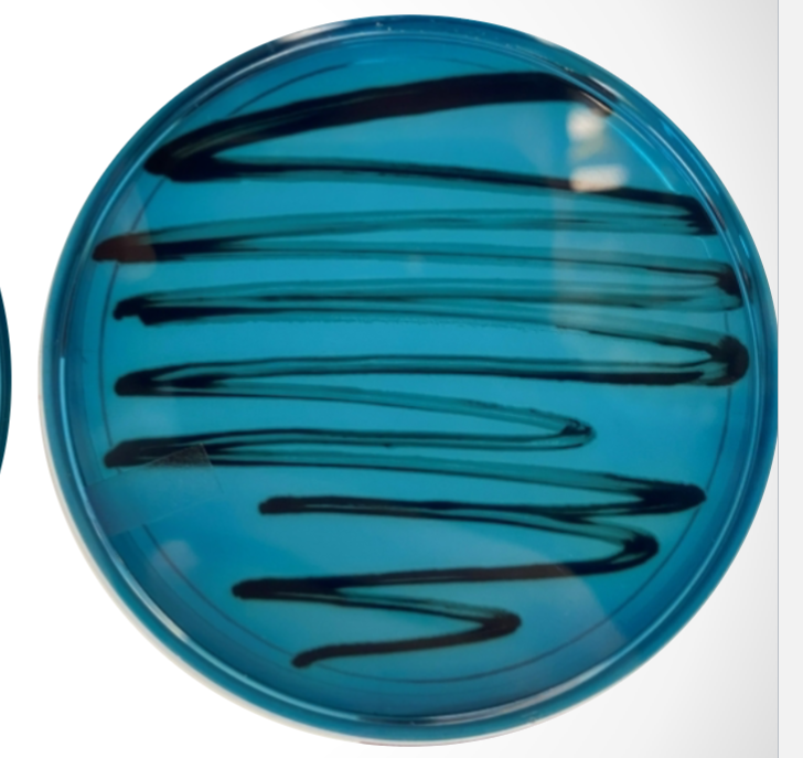 <p>What agar is used in this test? What bacteria was used and what does the reaction suggest?</p>