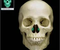 <p>shelf like projection of bone, located on each side of the nasal septum, attached to the lateral wall of the nasal cavity; increase epithelial surface area and create turbulence in the inspired air</p>