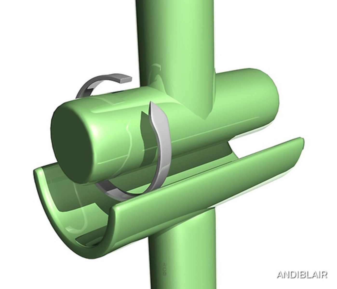 <p>Joint between bones that permits motion in only one planehinge</p>