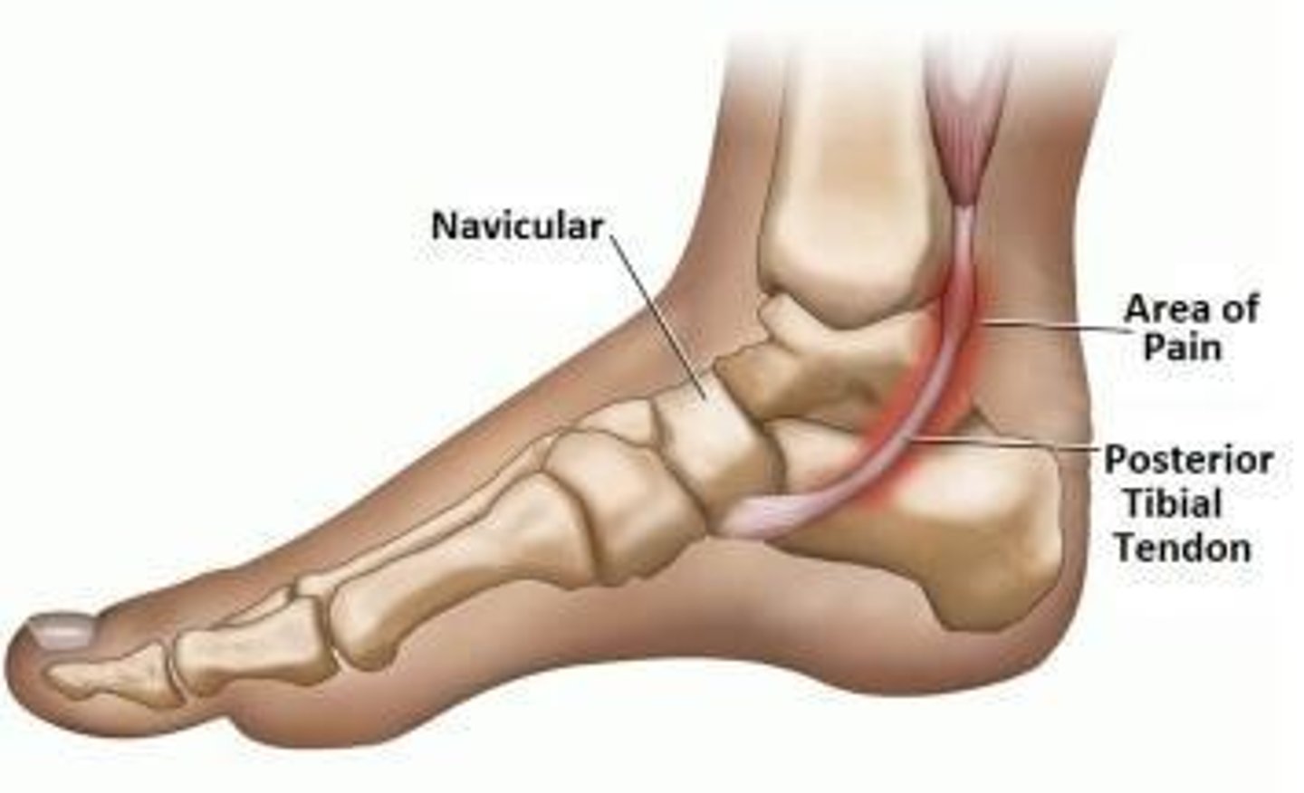 <p>Both conditions tend to have similar causes related to muscular imbalance and foot structure.</p>