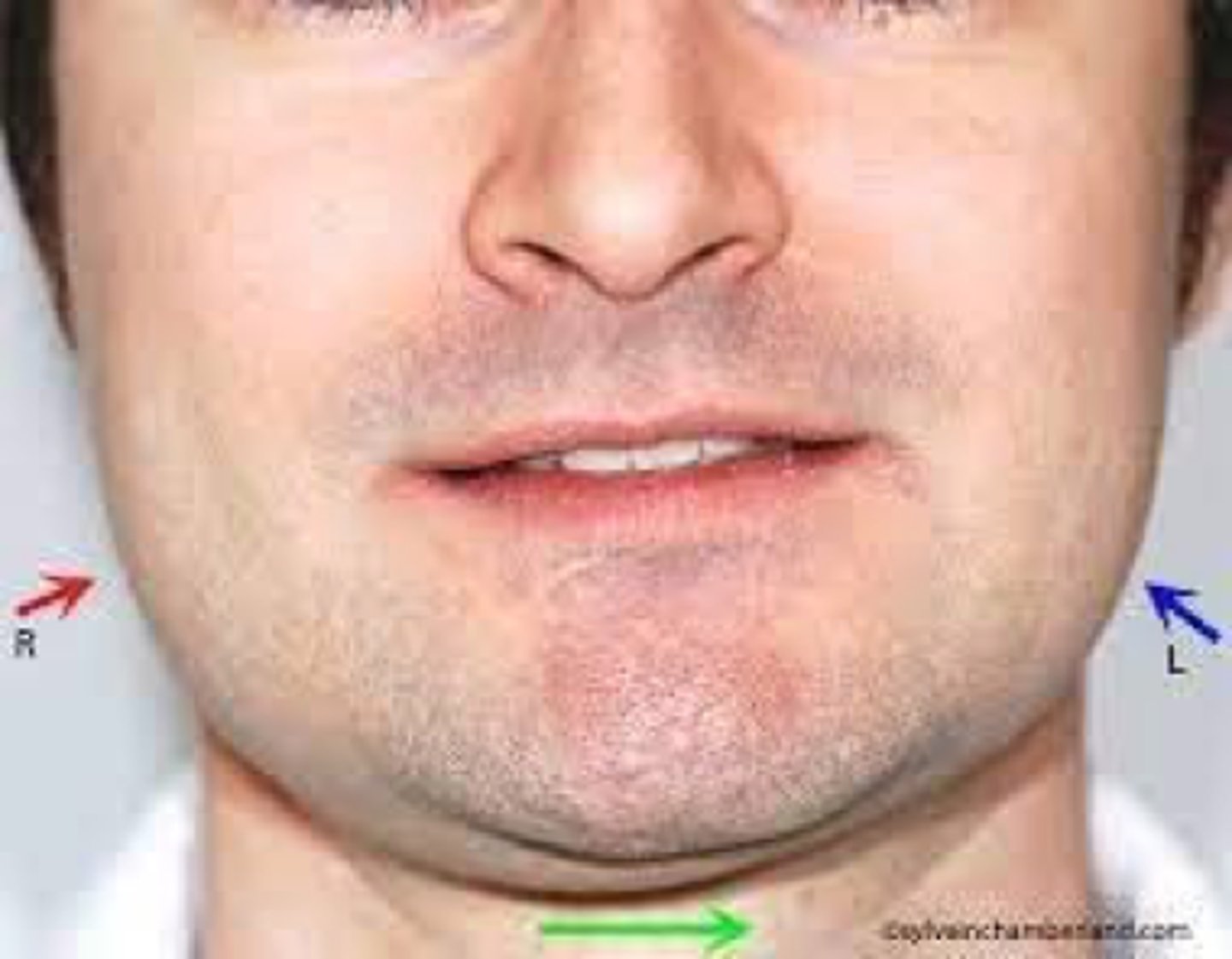 <p>What's with the masseter?</p>