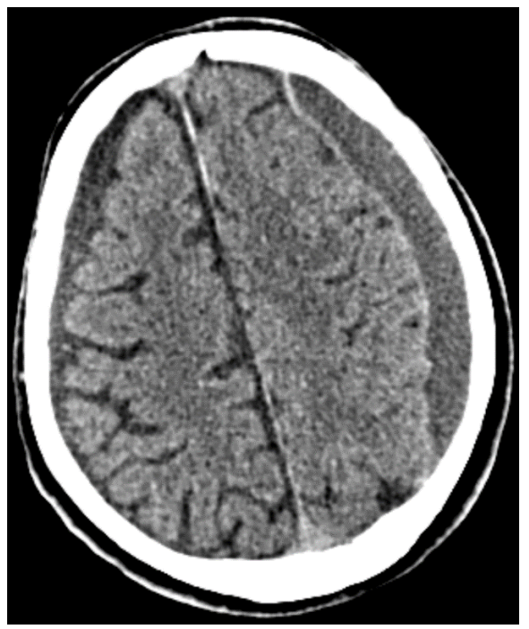 <p>What is shown in this CT image?</p>