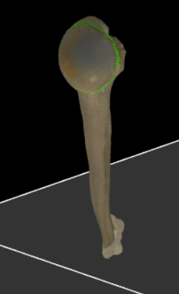 <p>Groeve rondom het gladde articulatievlak van het caput humeri.</p>