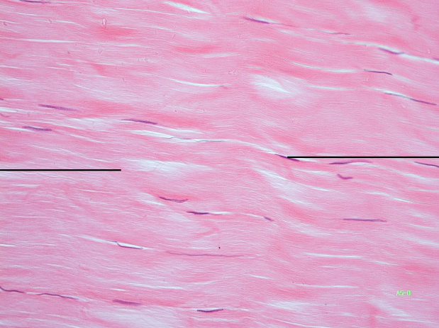 <p>Dense regular connective</p>
