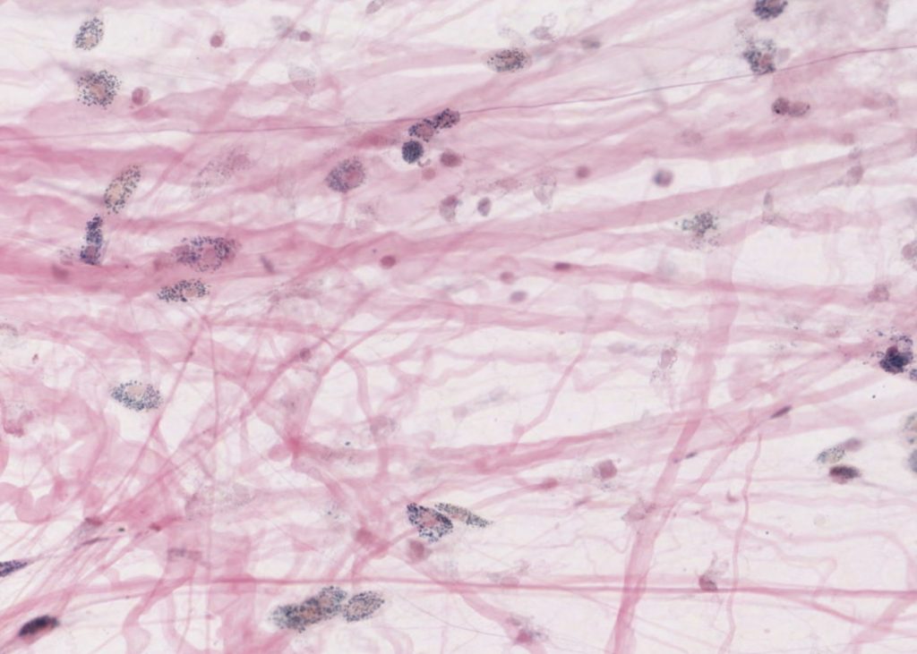 <p>Connective Tissue</p>
