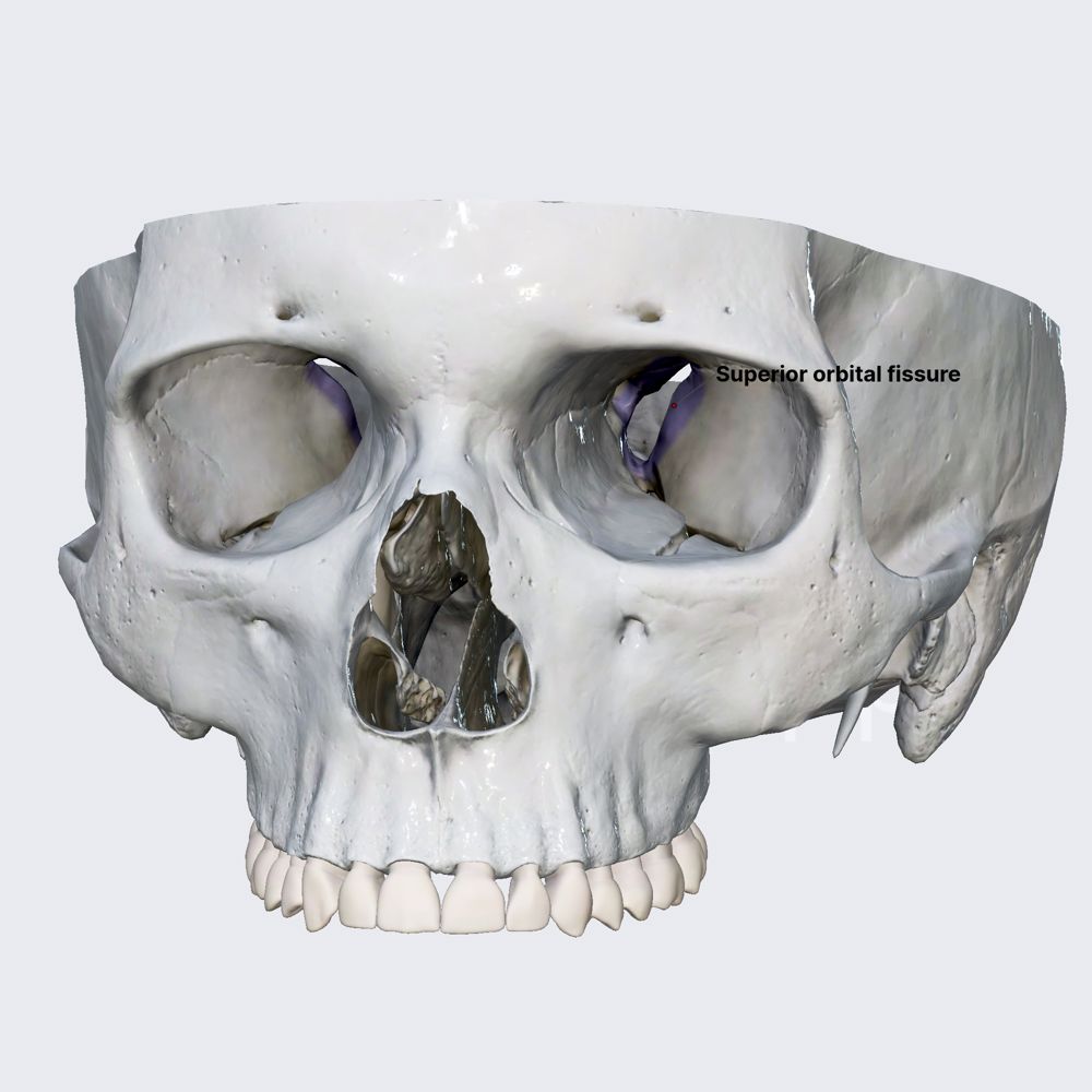 <p>CN III: oculomotor</p>