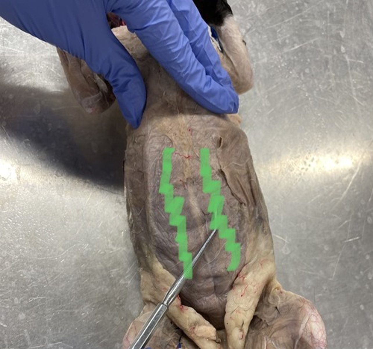 <p>O: pubic symphysis</p><p>I: costal cartilages</p><p>A: flex trunk; compress abdomen</p>