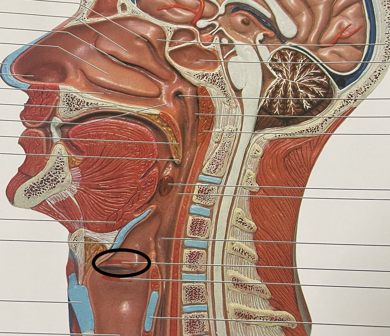 triangular shaped; fold