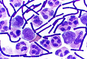 <p>purple and thick </p><ul><li><p>wall is made of peptidoglycan lipoteichoic acid </p></li></ul><p></p>