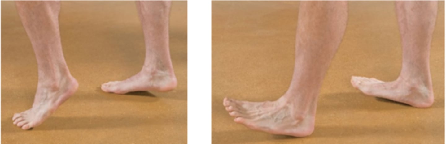 <p>Assessment for:</p><p>- L5 or S1 nerve root motor deficiency</p>