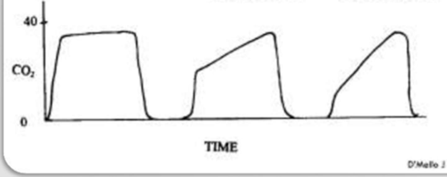 <p>What could explain the capnograph?</p>