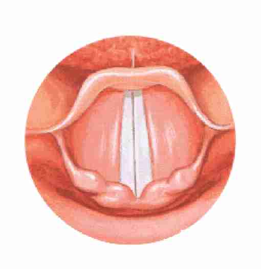 <p>vocal folds during speech</p>