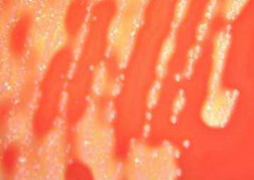 <p>What curved GNR has runny tan/pink colonies on selective media?</p>