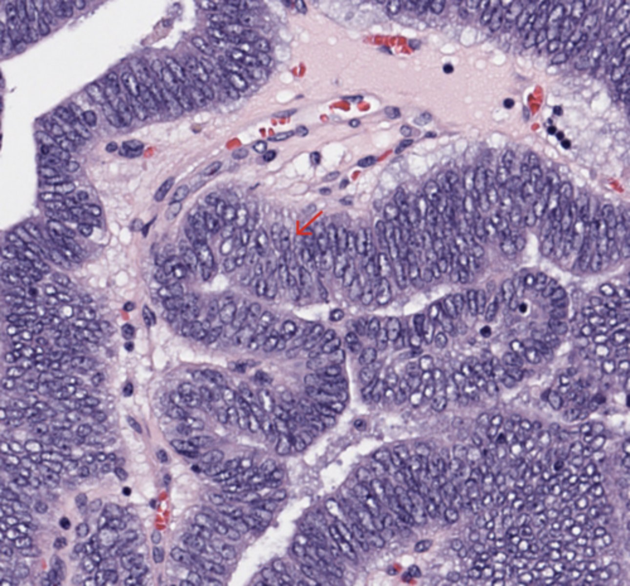 <p>Prostate</p>