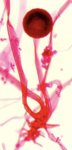 <p>Rhizopus Oryzae</p>