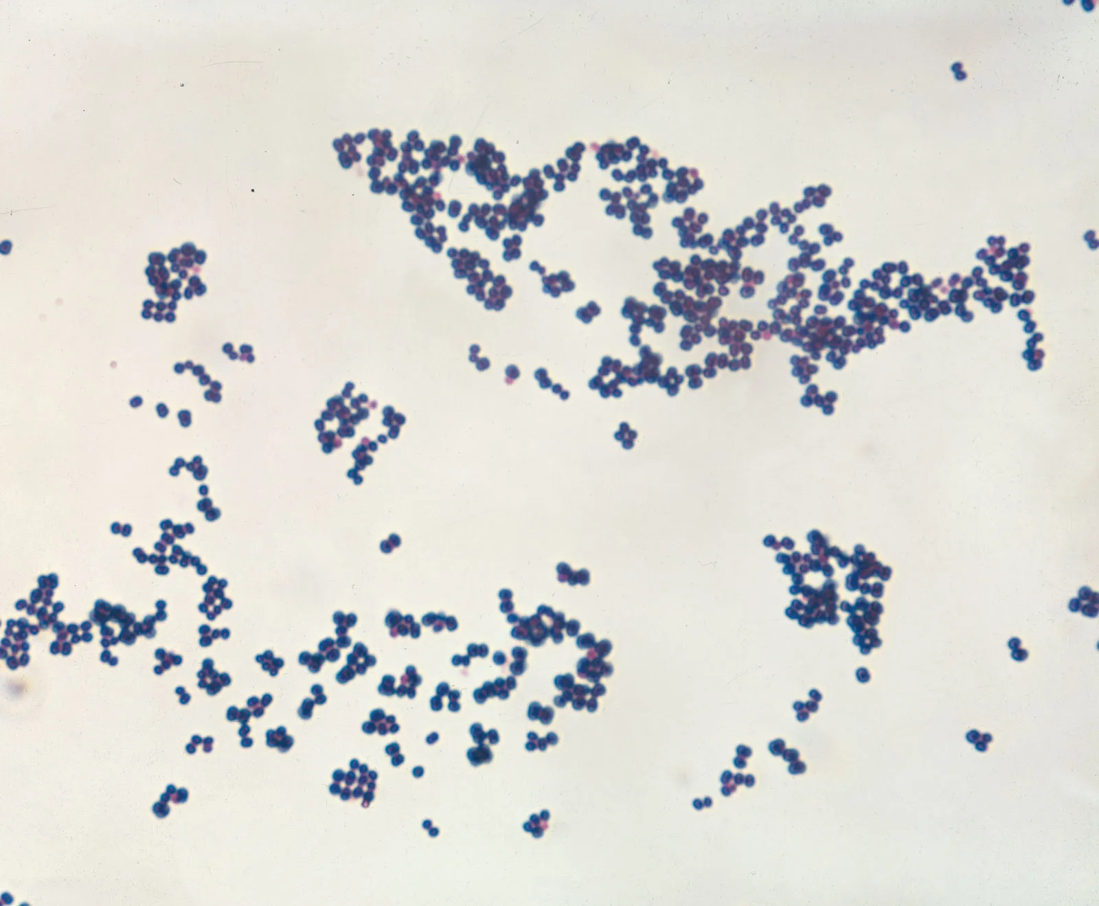 <p>cocci in groups/clusters</p>