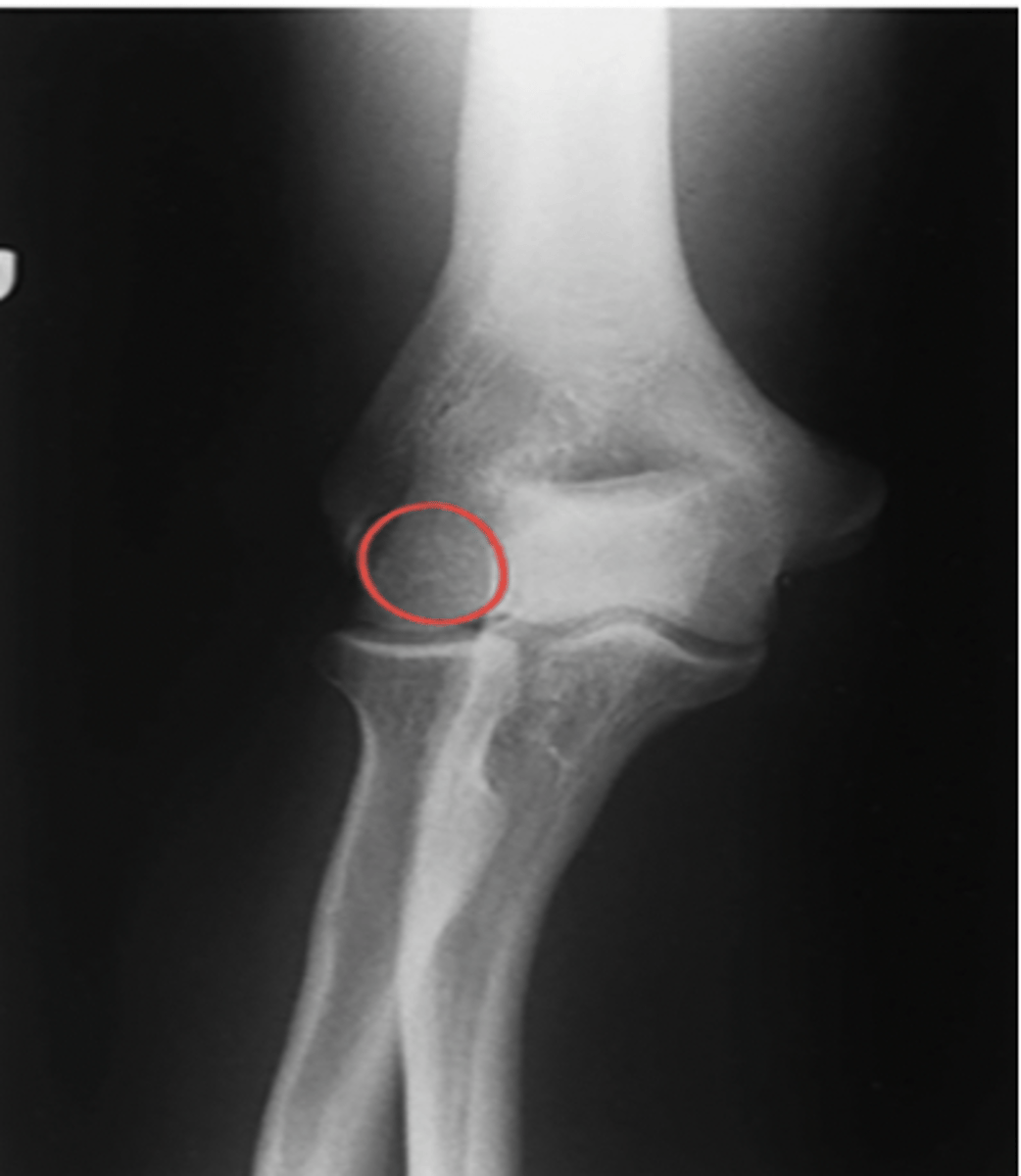 <p>What structure is highlighted?</p>