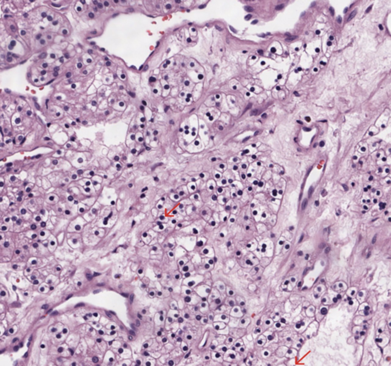 <p>Kidney</p>