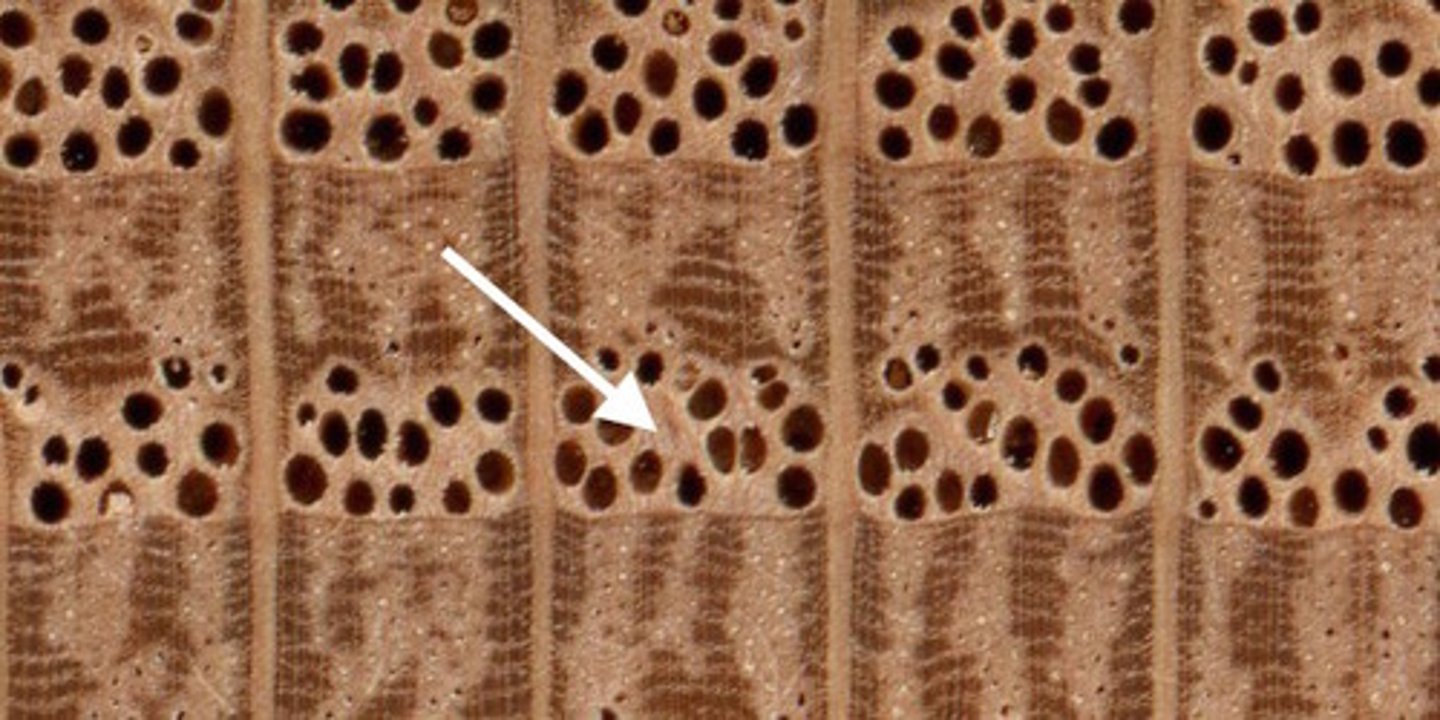 <p>= springwood, lighter colored wood formed during the spring that is:<br>i) Less dense<br>ii) Grow more<br>-Has more water available</p>