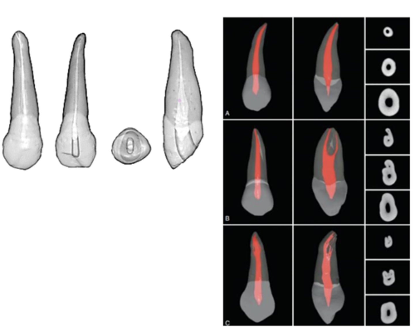 <p>maxillary canine</p>
