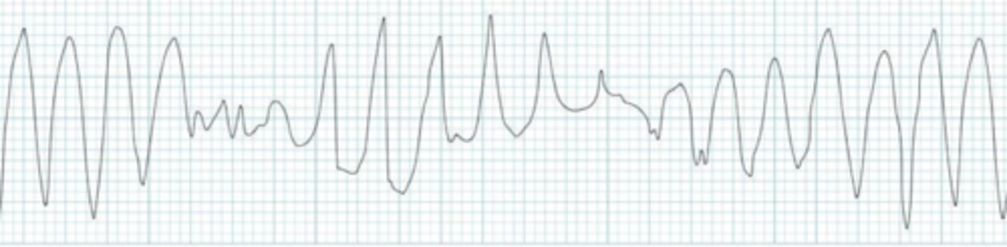 <p>Name the rhythm</p>