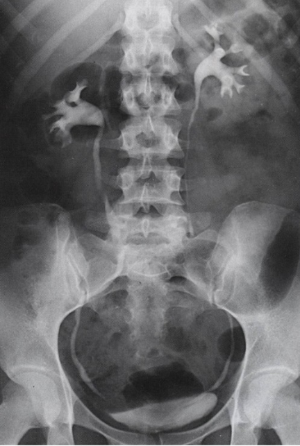 <p><span>What contrast procedure was performed to produce this image?</span><br></p>