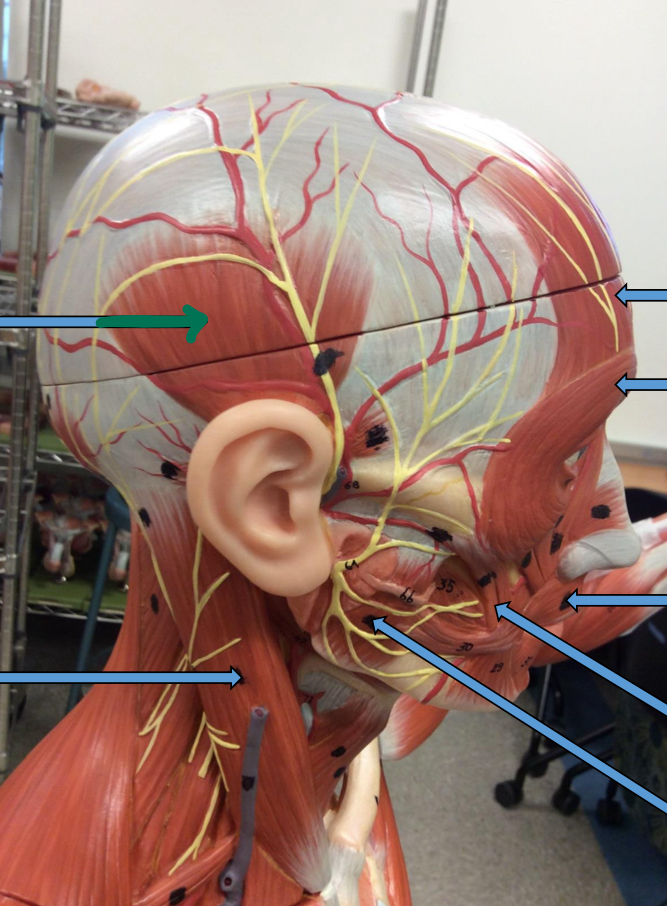 <p>Identify this muscle?</p>