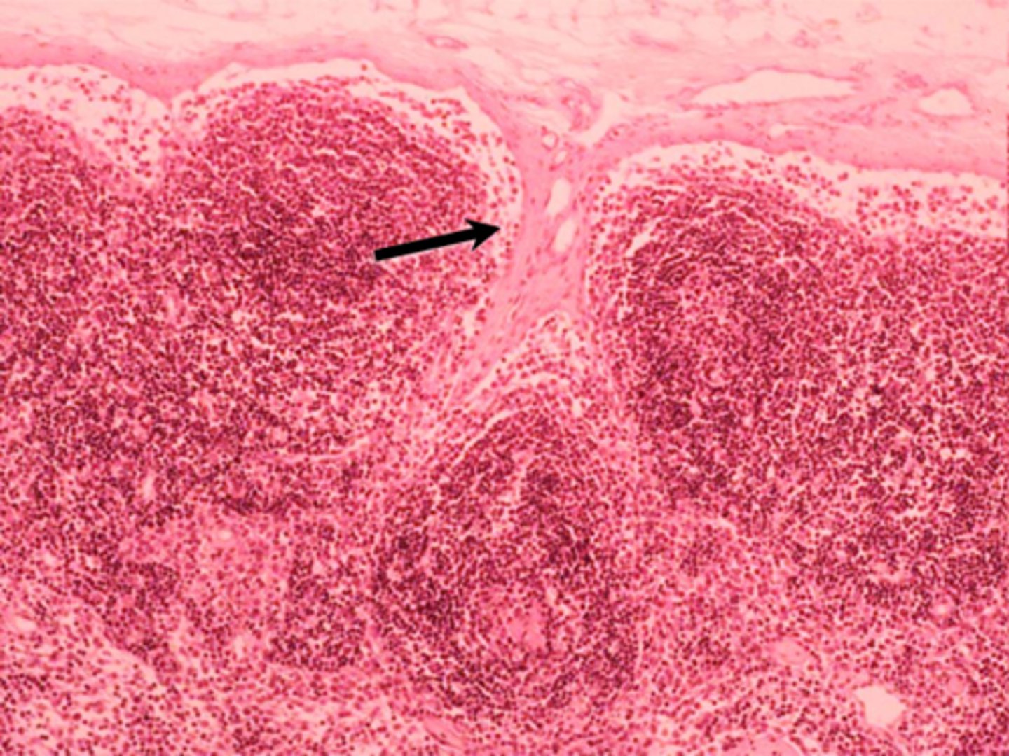 <p>black arrow</p><p>peritrabecular sinus</p>