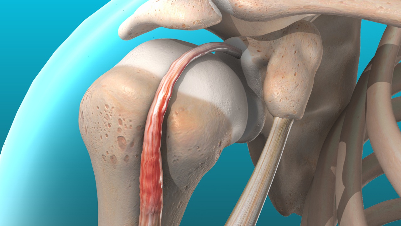 <p>Diagnose this injury. Provide Moi, signs and symptoms and management</p>