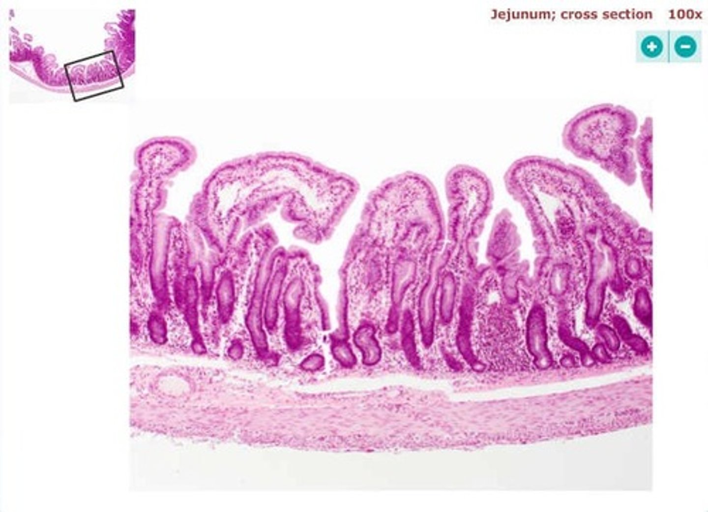 <p>simple columnar epithelium</p>