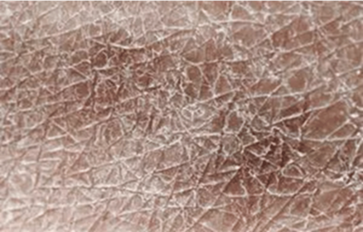 <p>Thin parchment as subcutaneous fat decreases Decreased mobility and turgor Decreased hair growth, nail growth, and brittle nails</p>