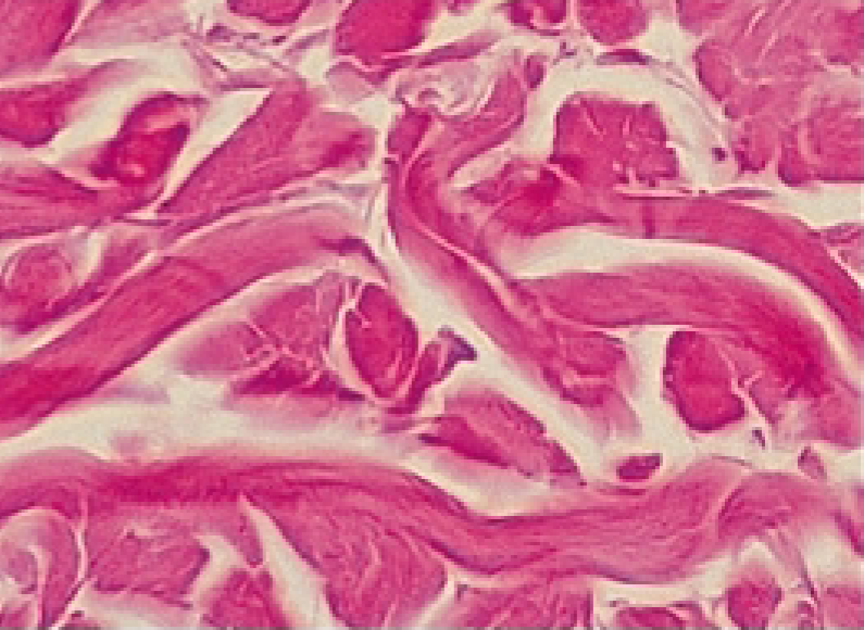 <p>What is the function of the dense irregular connective tissue?</p>