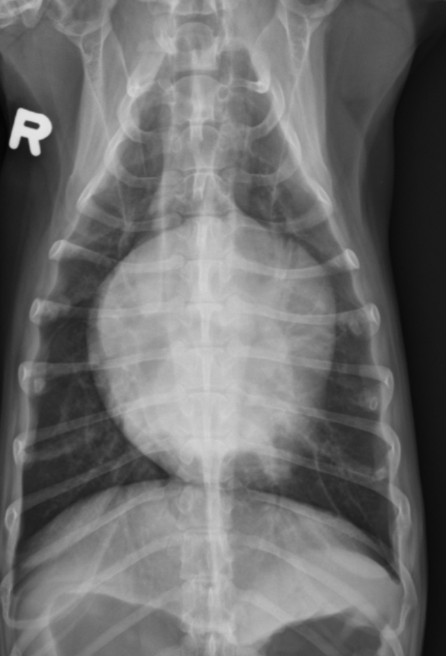 <p>What part of the heart is enlarged</p>