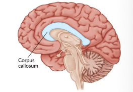 <ul><li><p>Mass of nerve cells and supportive tissue in CSF [ Cerebrospinal fluid]</p></li><li><p>Brain is completely dependent on a constant supply of oxygen and nutrients.</p></li><li><p>Cerebrum: 2 hemispheres (L &amp; R) sit atop brain stem</p></li><li><p>Longitudinal cerebral fissure divides two hemispheres</p></li><li><p>Hemispheres communicate via corpus callosum</p></li><li><p>Receive sensory information from contralateral side of body and movement is affected on contralateral side of body</p></li></ul><p></p><p>corpus callosum connect 2 sides of the brain —> contralateral issues</p><p>10 sec lose consciousness, 20 electrical currents stop, 2+ min permanent brain damage </p><p>Language in the LEFT</p><p>RIGHT —> emotions, music cognitive (memory/planning, pragmatics)</p>