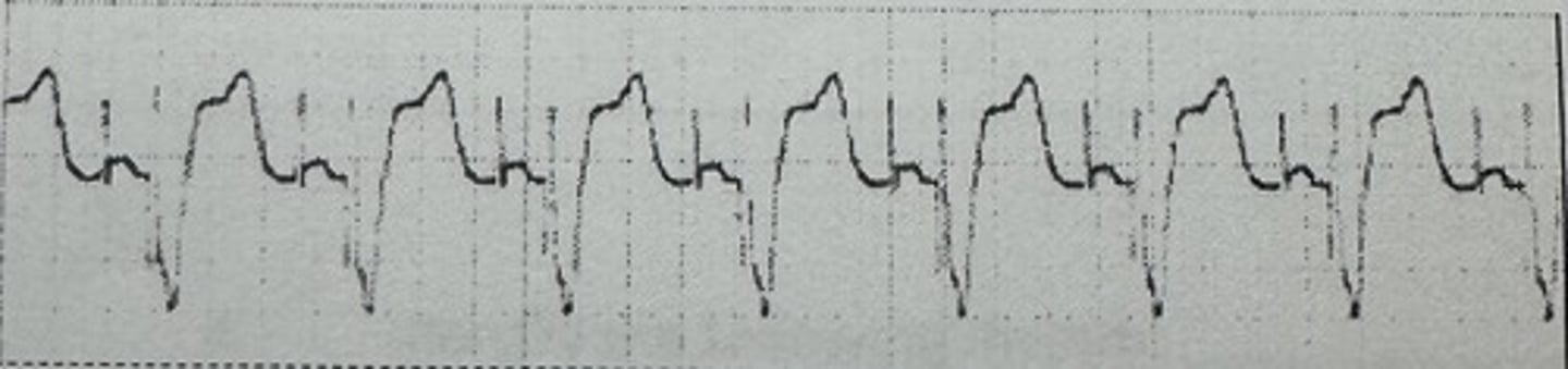 <p>identify the rhythm</p>