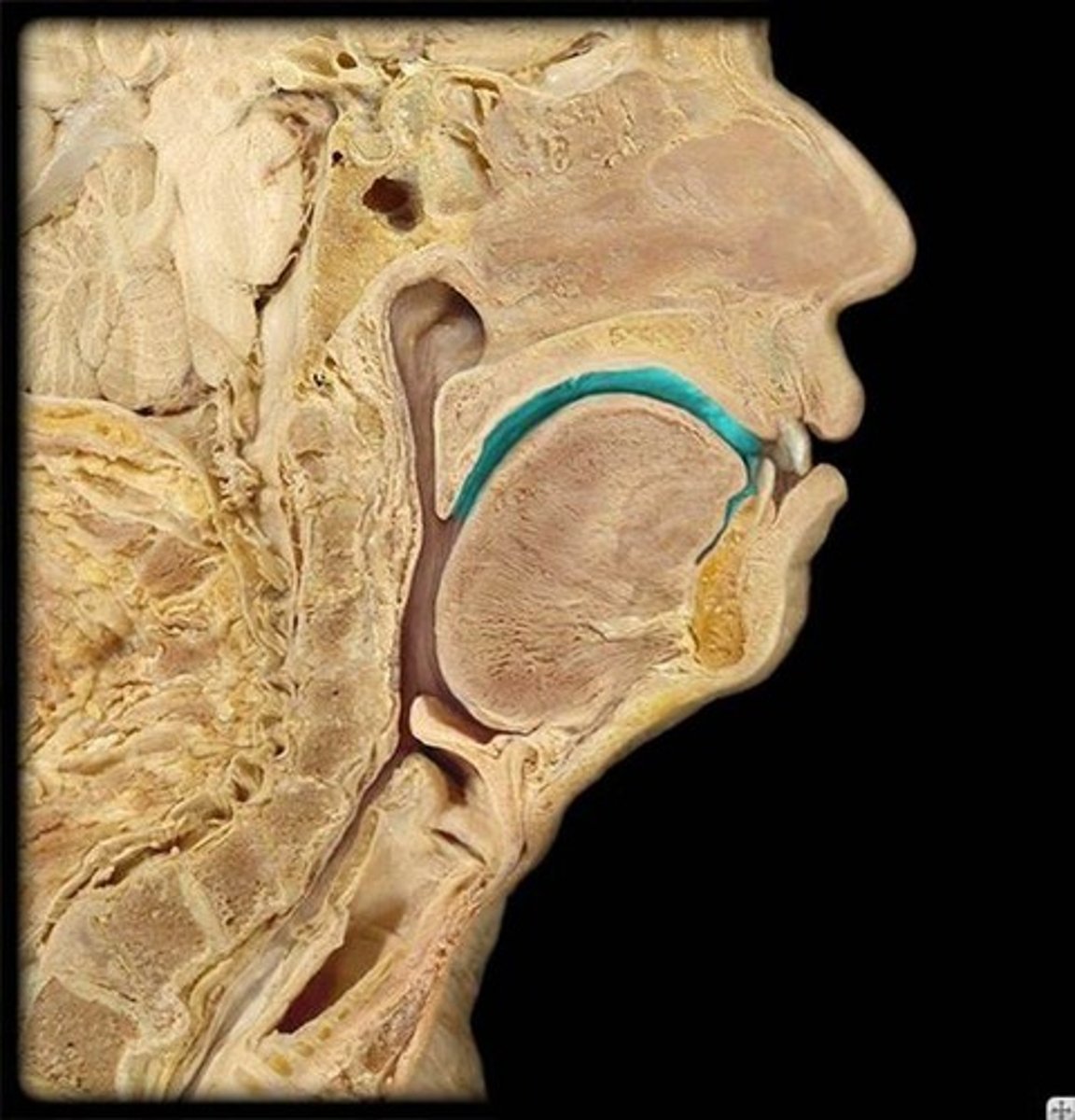 <p>What is the more anatomical term for the mouth?</p>
