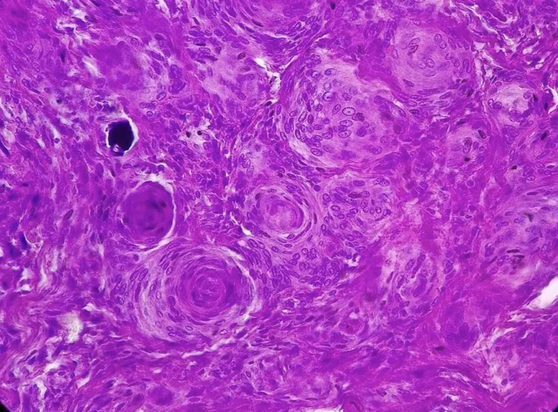 term image