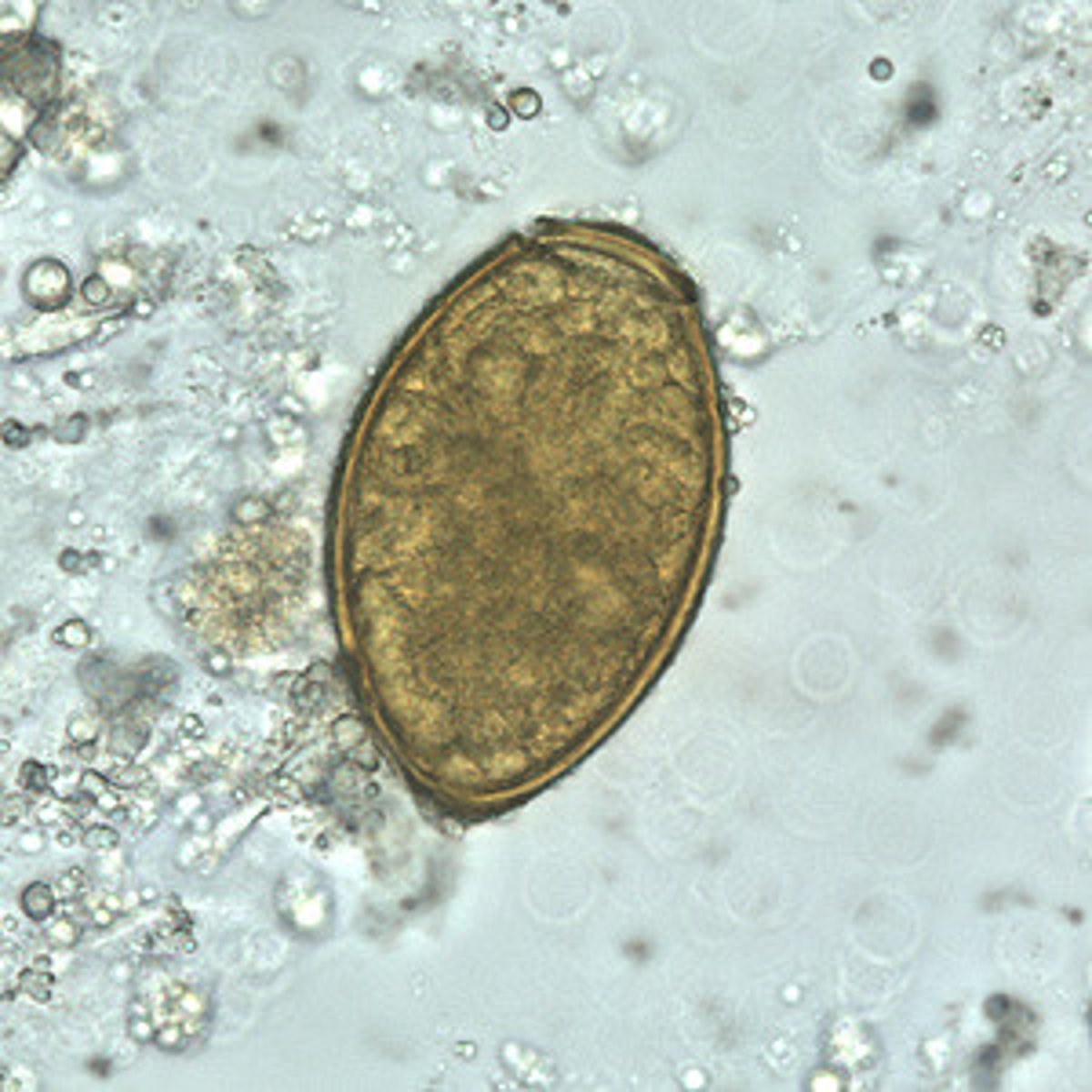 <p>thickened abopercular end</p>