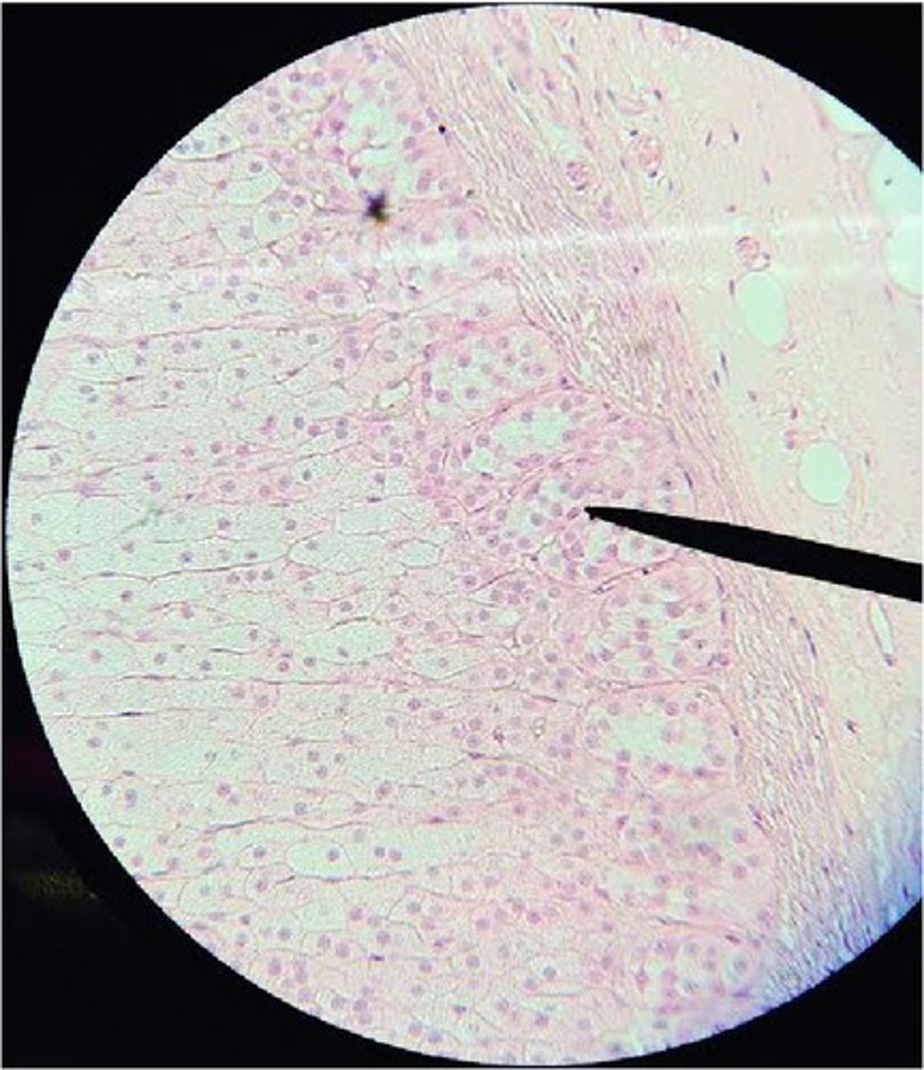 <p>A. Label B. Hormone made there</p>