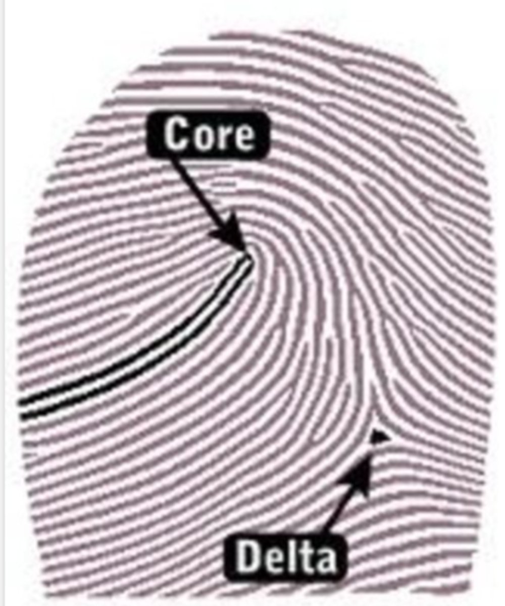 <p>Center of pattern</p>