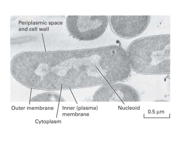 <ul><li><p><strong>cell wall surrounding the cellular membrane&nbsp;</strong></p><ul><li><p>gramm negative bacteria contian outer membrane that surrounds cell wall</p></li></ul></li><li><p>typically<strong> no membrane bound organelles in the cell</strong></p><ul><li><p><strong>chromosomes are in the cytoplasm</strong></p><ul><li><p>allows <strong>translation to occur on RNA before transcription even finished</strong></p></li></ul></li></ul></li></ul><p></p>